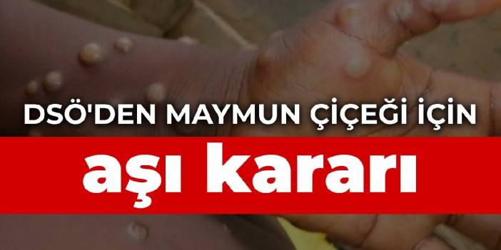 DSÖ'den maymun çiçeği için aşı kararı