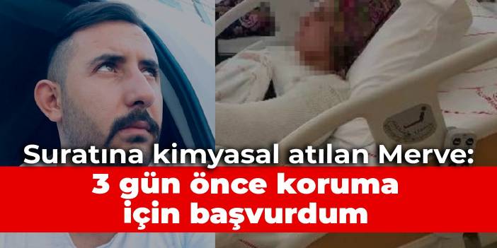 Suratına kimyasal atılan Merve: 3 gün önce koruma için başvurdum