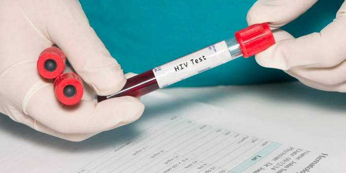 Dirençli donörden kök hücre nakliyle 4 kişi HIV'den kurtuldu