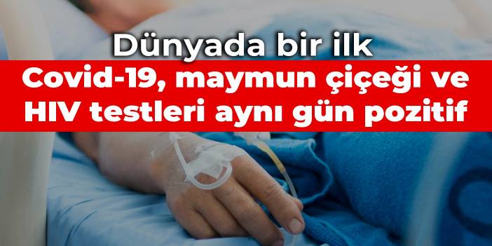 Dünyada bir ilk: Covid-19, maymun çiçeği ve HIV testleri aynı gün pozitif