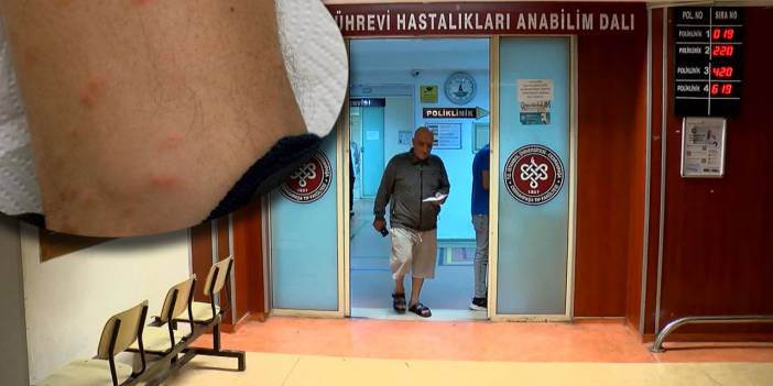 İstanbul'da sivrisinek alarmı!  Cinsi 'Aedes', saldırgan bir tür