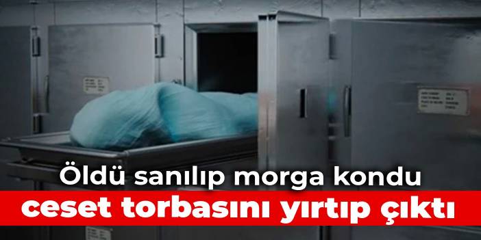 Öldü sanılıp morga kondu, ceset torbasını yırtıp çıktı