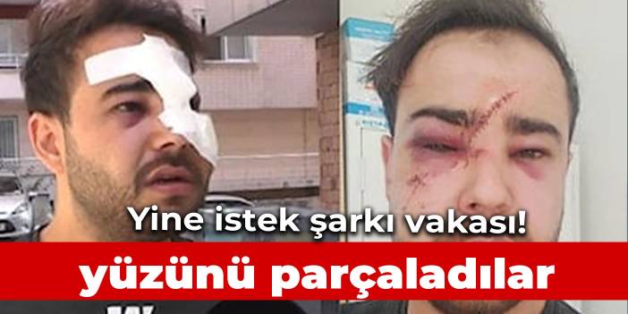 İkinci Onur Şener vakası! İstek parçayı çalmadı diye yüzünü parçaladılar