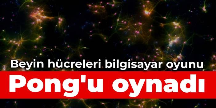 Beyin hücreleri bilgisayar oyunu Pong'u oynadı