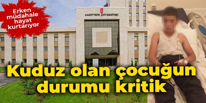 Kuduz olan çocuğun durumu kritik