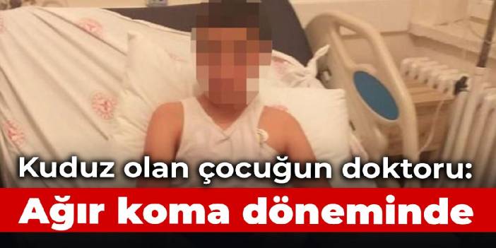 Kuduz olan çocuğun doktoru son durumunu anlattı: Ağır koma döneminde