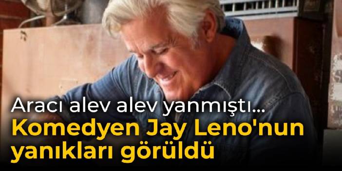 Aracı alev alev yanmıştı... Komedyen Jay Leno'nun yanıkları görüldü