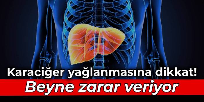 Karaciğer yağlanmasına dikkat! Beyne zarar veriyor