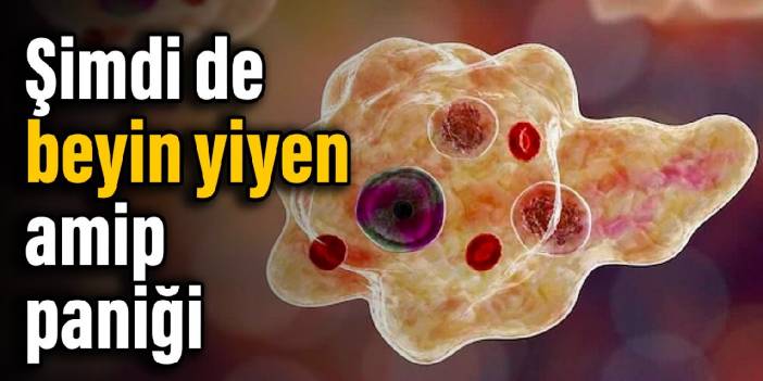 Kore'de ilk ölüm: Beyin yiyen amip. Nasıl bulaşır, belirtileri neler, insandan insana geçer mi?