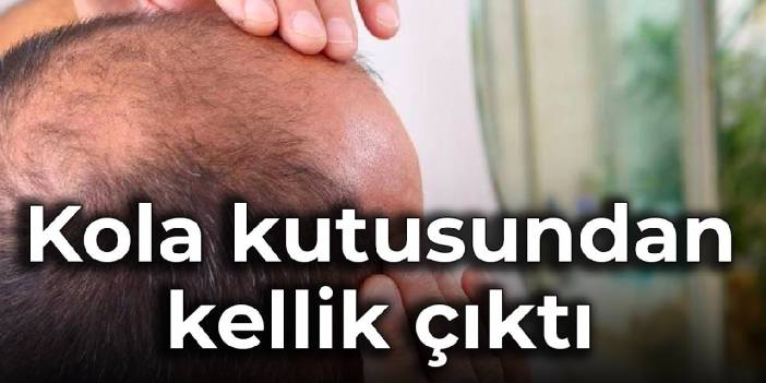 Kola kutusundan kellik çıktı