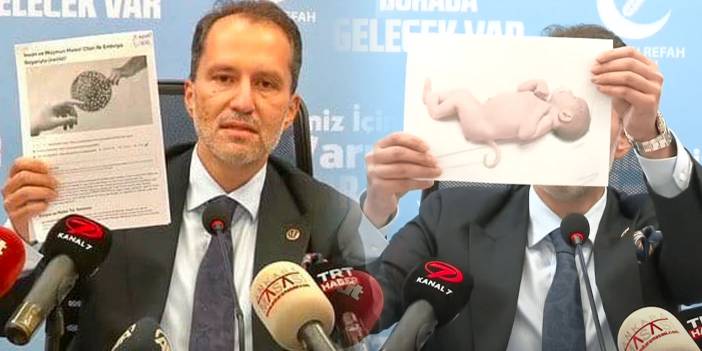 Fatih Erbakan'ın aşı kehanetleri... 'Kuyruklu bebek' videosu yeniden viral oldu