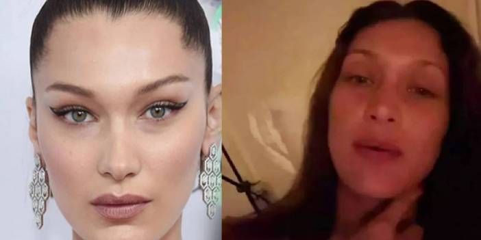 Bella Hadid'in zor günleri:  Tedavisi olmayan acılar çekiyorum