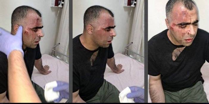 Gazeteciyi Darp Edenlerle İlgili Flaş Gelişme! Başkanın Korumaları Tutuklandı