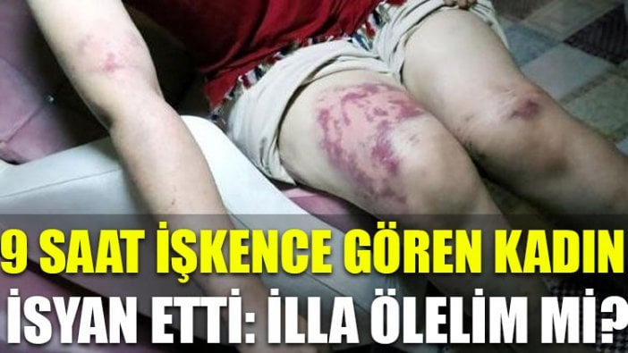 9 saat işkence gören kadın isyan etti: İlla ölelim mi?