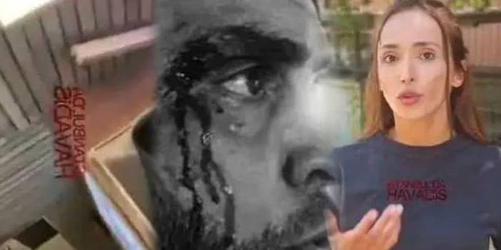 Tacizciyi Evire Çevire Dövmüştü... Feray Açıkgöz: Bu Defa Çok Sert Kayaya Çarptı