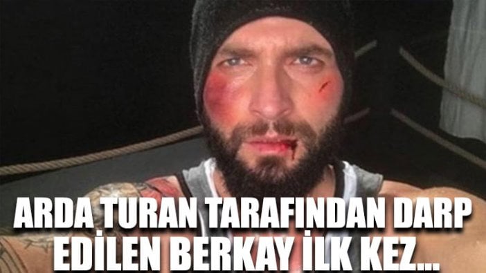 Arda Turan tarafından darp edilen Berkay ilk kez...