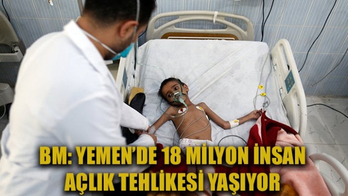 BM: Yemen'de 18 milyon kişi açlık tehdidi ile karşı karşıya