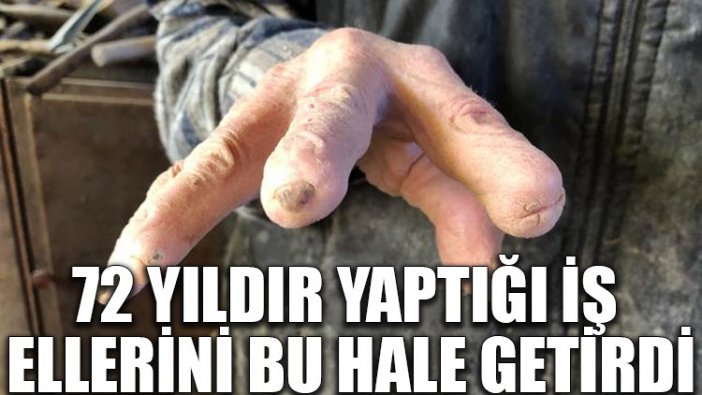 72 yıldır yaptığı iş ellerini bu hale getirdi