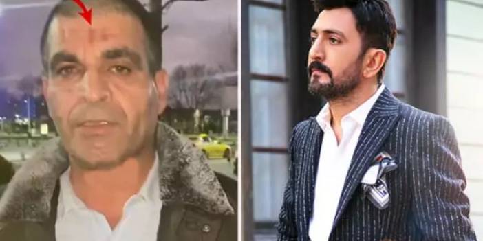 Şarkıcı Ferman Toprak'ın İşçileri Dövdüğü İddia Edildi: Silah Çekti, İşçiler Canını Zor Kurtardı