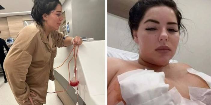 İngiliz Model, Estetik Surgery Yaptırayım Derken Meme Uçlarından Oldu!