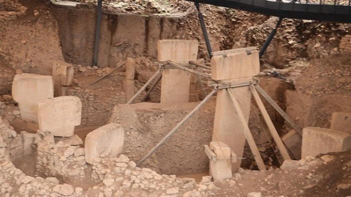 Dünyanın ilk ameliyatı Göbeklitepe'de yapılmış