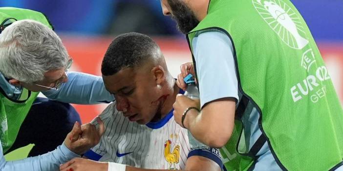 Mbappe Oyuna Devam Edememişti! Son Durumu Belli Oldu