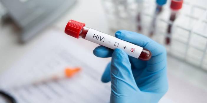 HIV Nedir? Bulaş Yolları Nasıl Gerçekleşir?