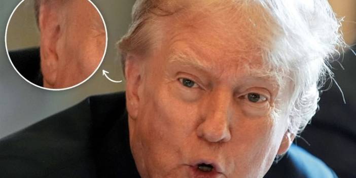 Bandaj çıktı Trump'un vurulmasıyla ilglii komplo teorileri uçuşmaya başladı