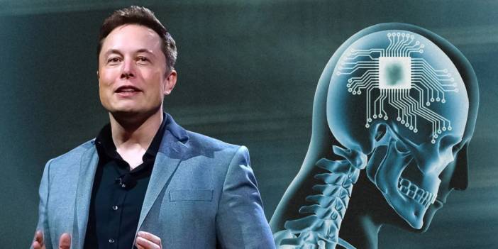 Elon Musk insanların beynine çip takmaya devam ediyor