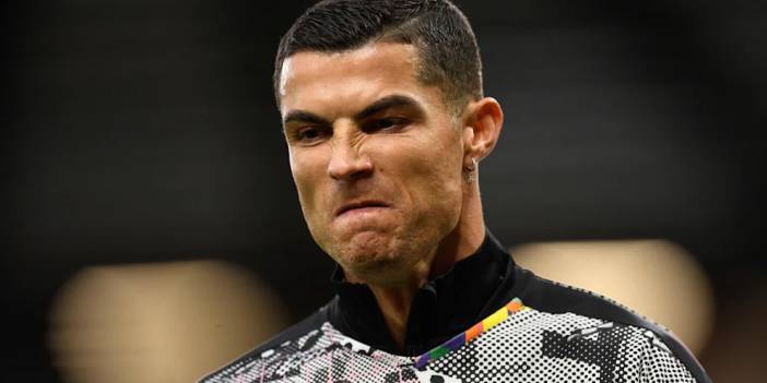 Ronaldo'nun başı botoksu yüzünden dertte