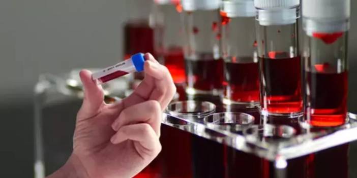 Bilim insanları açıkladı. İşte en zeki kan grupları