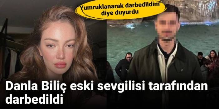 Danla Biliç eski sevgilisi tarafından darbedildi