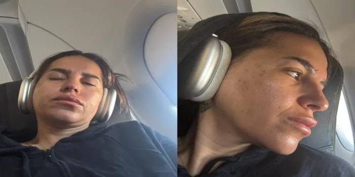 Gençlik aşısı yaptırdı yüz felci geçirdi