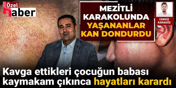 Kavga ettikleri çocuğun babası kaymakam çıkınca hayatları karardı: Mezitli karakolunda yaşananlar kan dondurdu