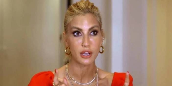 Çağla Şıkel paylaştı bacakları mosmor oldu