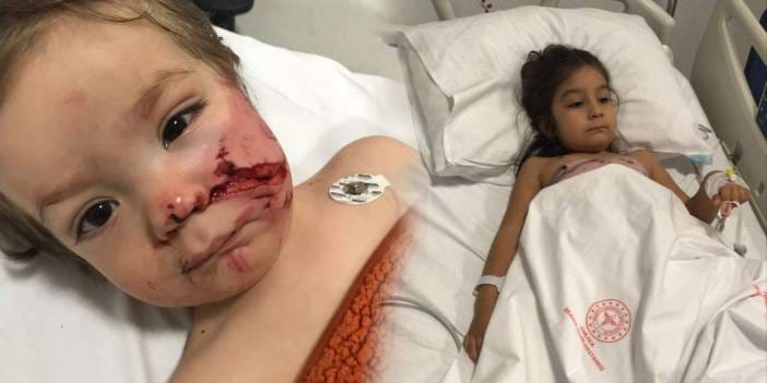 Pitbull saldırısında 1,5 ve 5 yaşındaki iki çocuk hastaneye kaldırıldı