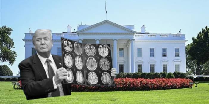 Mental yeterliliği sorgulanmıştı: Trump'ın beyin emarı paylaşılacak