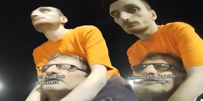 31 yaşındaki oğlunu omzunda taşıyan baba isyan etti: Otizmi bitiremeyiz o bizi bitirecek