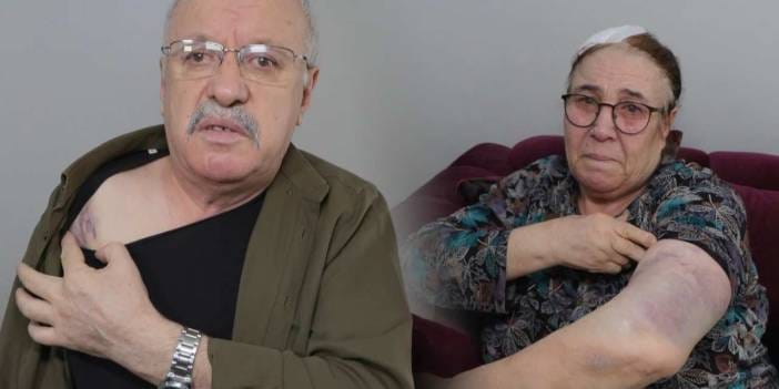 Esenyurt’ta komşu dehşeti! 1 yıldır tehditler savurduğu yaşlı çifti sopayla darbetti