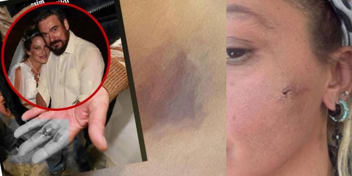 Ünlü oyuncu Yıldız Asyalı yardım çağrısında bulundu: Önce beni sonra babamı darp etti