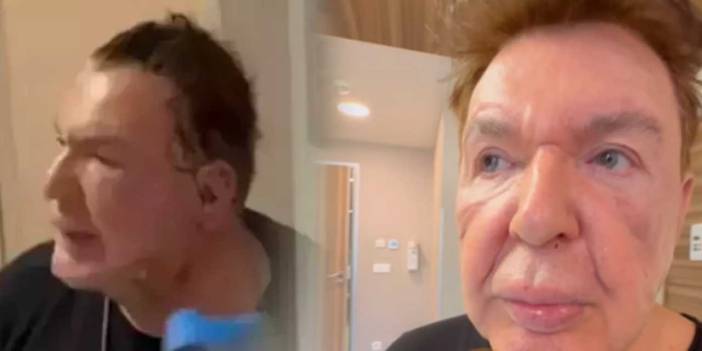 Kuşum Aydın son halini paylaştı! Yüzündeki şişlikler gündem olmuştu