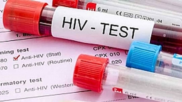 HIV-pozitif sperm bankası kuruldu