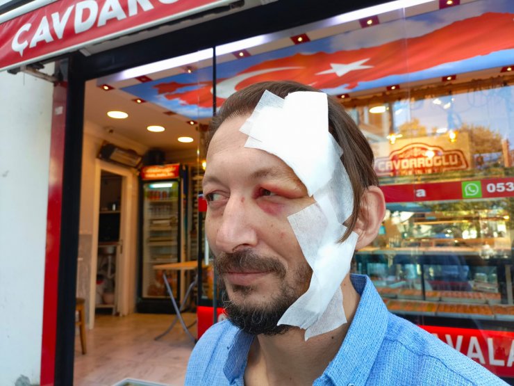 İstanbul'da Akılalmaz Olay! 'Ne Bakıyorsun' Deyip Başından Bıçakladı