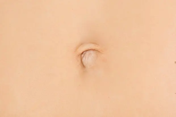 kh-composite-off-centre-navel-2.webp