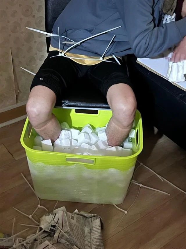 man-uses-dry-ice-to-amputate-both-legs-for-insurance-fraud-v0-mcoivpmiuioc1.webp
