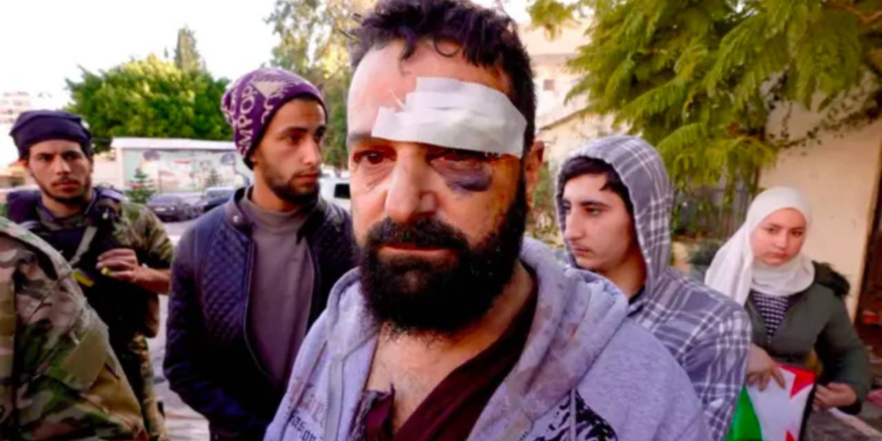 aranin-gucleri-lazkiye-katliamini-izledi-ingilizlerden-yeri-yerinden-oynatacak-iddia-2.jpg