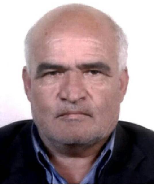 2-kulagi-ve-yuzunun-bir-kismi-kesilmis-h-732121-216280.jpg